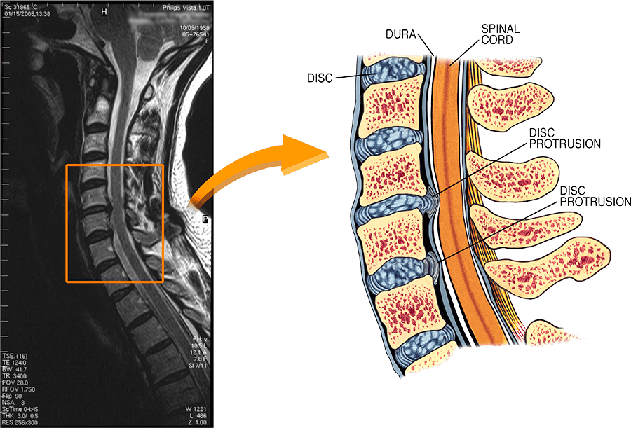 영등포한의원 여의도한의원 영등포역한의원 선한의원 목디스크MRI